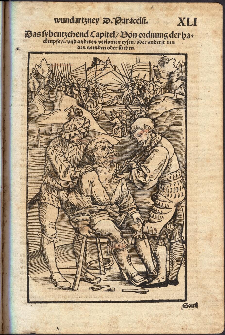 Haavuri irrottaa nuolta potilaan rinnasta